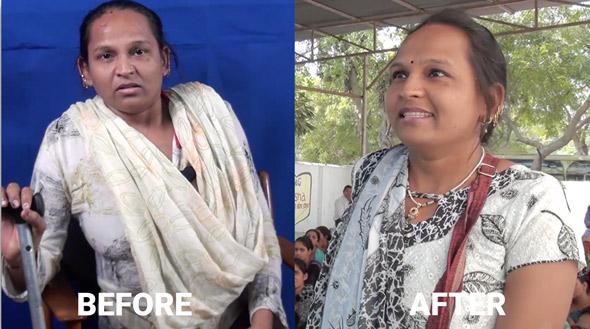 Geeta Rana, livelihood training beneficiary, before and after